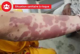 Situation sanitaire à risque