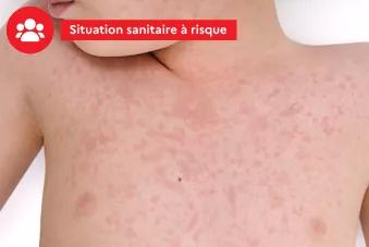 Situation sanitaire à risque
