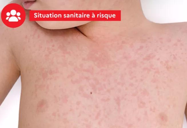 Situation sanitaire à risque